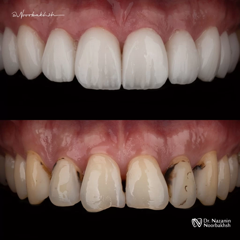 a great smile makeover