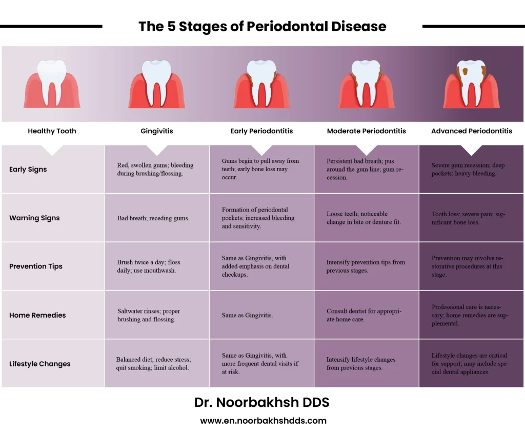 The stages of Periodontal disease with signs and preventing strategies