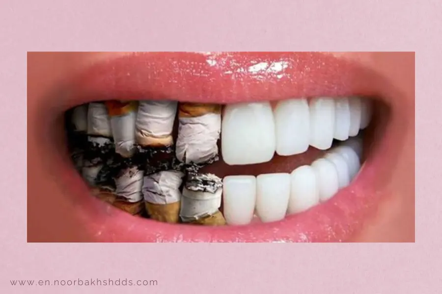 Smoking-effect-on-oral-health