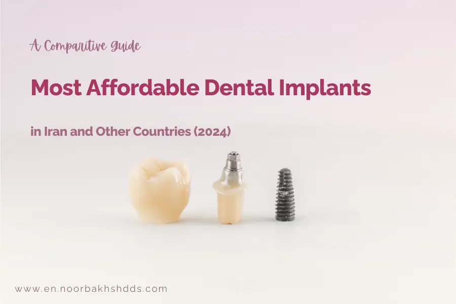 A comparison of Most affordable dental implants in Iran and other countries