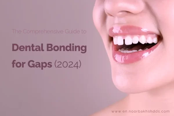 The Comprehensive Guide to Dental Bonding for Gaps 2024